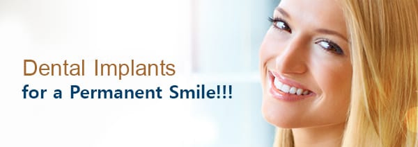 Dental Implants